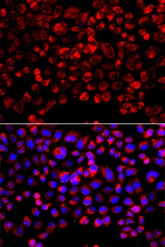 SULT1E1 Antibody