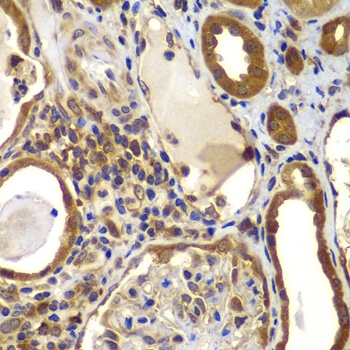 NME2 Antibody