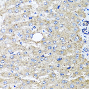 DFNA5 Antibody