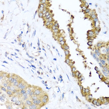 DFNA5 Antibody