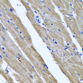 DFNA5 Antibody