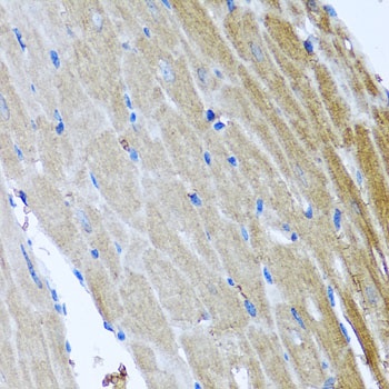 DFNA5 Antibody