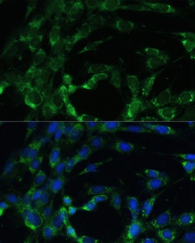BCAT2 Antibody