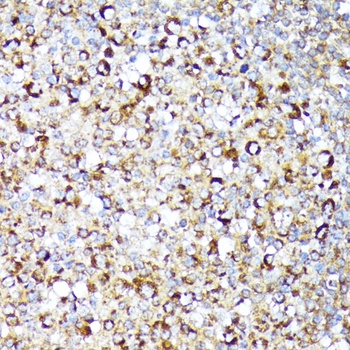 RIPK1 Antibody