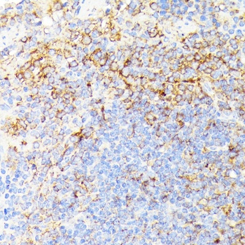 RIPK1 Antibody