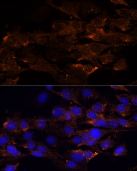 RIPK1 Antibody