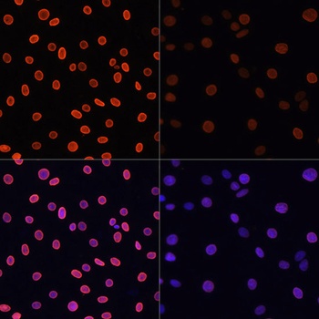H4K91ac Antibody