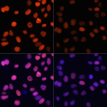 H4K91ac Antibody