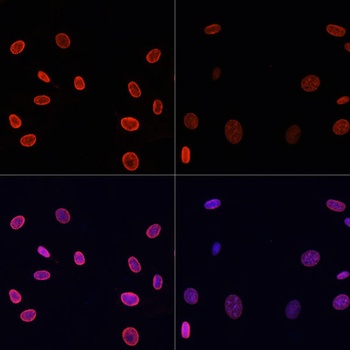 H4K91ac Antibody