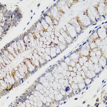 CHMP4B Antibody