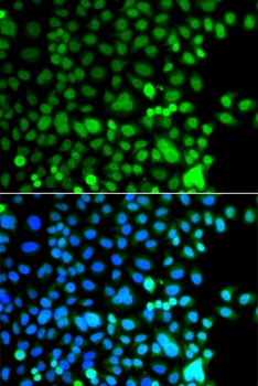 AEBP2 Antibody