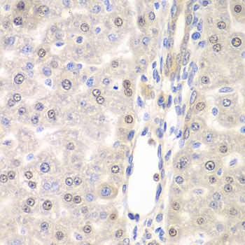 DTX2 Antibody