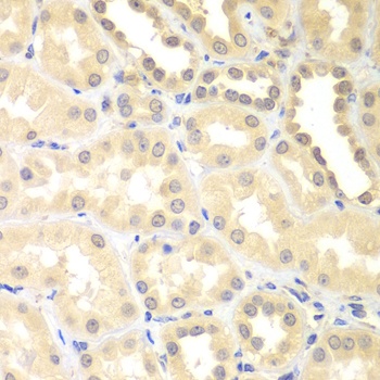 DTX2 Antibody