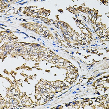 RASSF5 Antibody