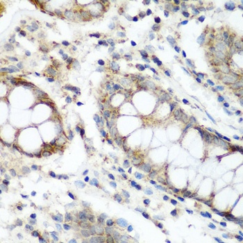 NAA60 Antibody