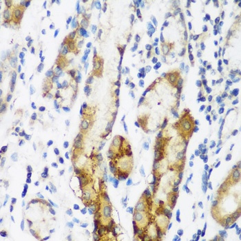 NAA60 Antibody