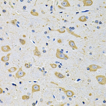 FASTKD1 Antibody