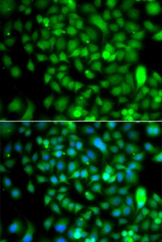 CSRP2BP Antibody