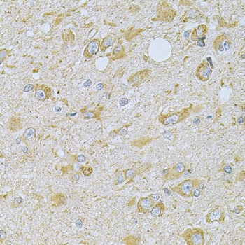 CAMK1G Antibody