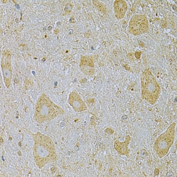 CAMK1G Antibody