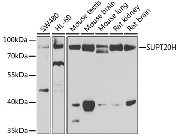 SUPT20H Antibody