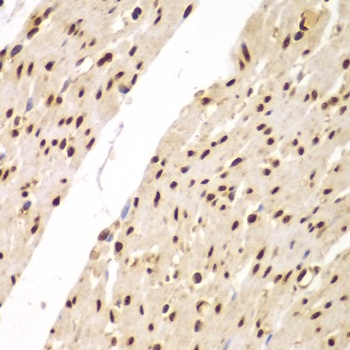 SUPT20H Antibody