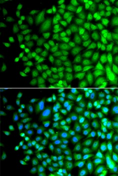 SUPT20H Antibody