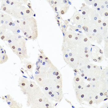 CHRAC1 Antibody