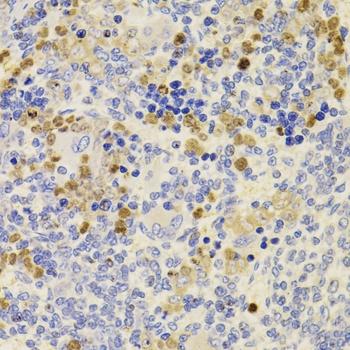 PRDM5 Antibody