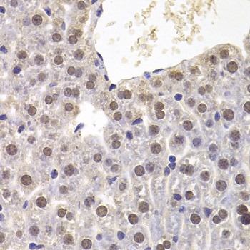 PRDM5 Antibody