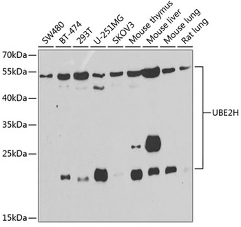 UBE2H Antibody