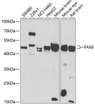 PAX6 Antibody