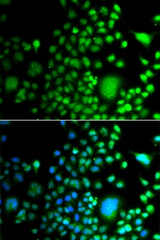 PAX6 Antibody