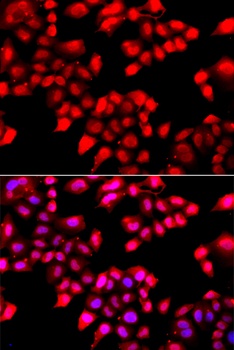 XRCC6 Antibody