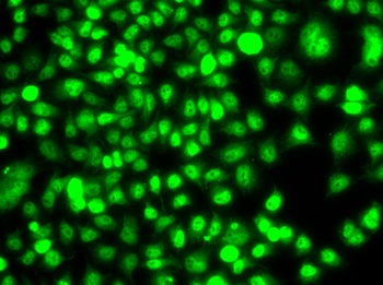 ETS2 Antibody