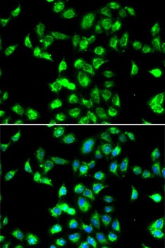 SERPINA4 Antibody