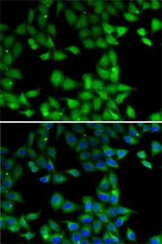 MPI Antibody
