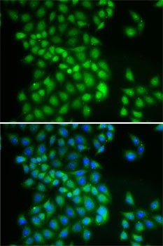 YTHDC1 Antibody