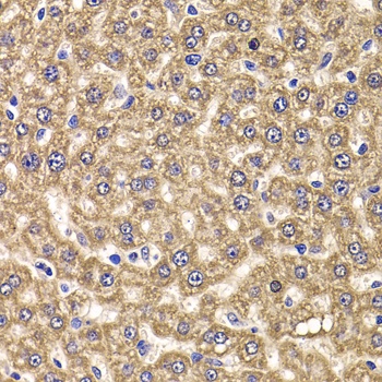 UBE2J2 Antibody