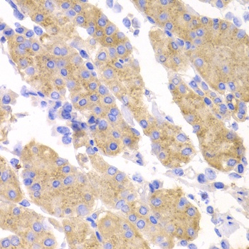 SMYD4 Antibody