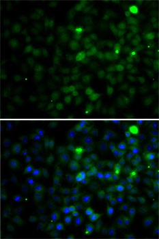 SMYD4 Antibody