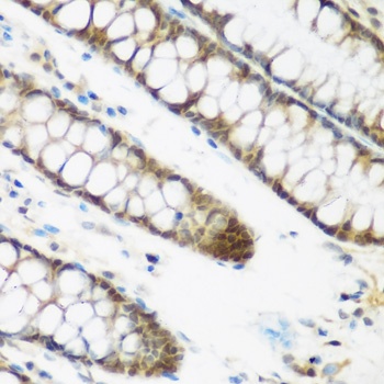 NCBP2 Antibody