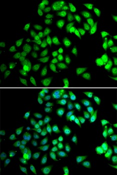 NCBP2 Antibody