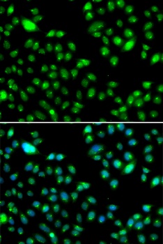 L3MBTL3 Antibody