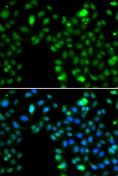 ING5 Antibody