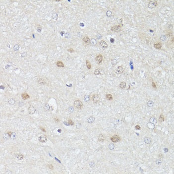 GRM4 Antibody