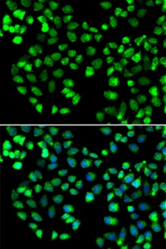 GRM4 Antibody