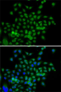 BCAS3 Antibody