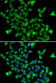 ASPA Antibody