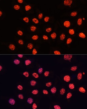 TriMethyl-Histone H3-K56 pAb